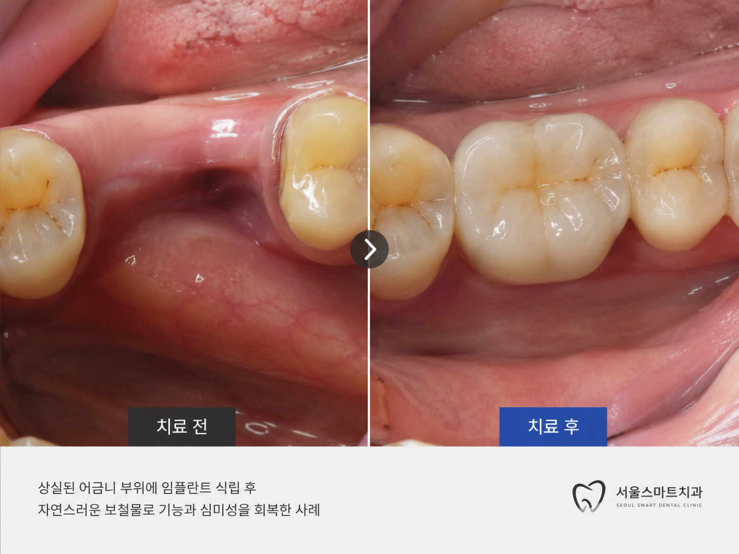 부평 어린이·청소년 일반 진료